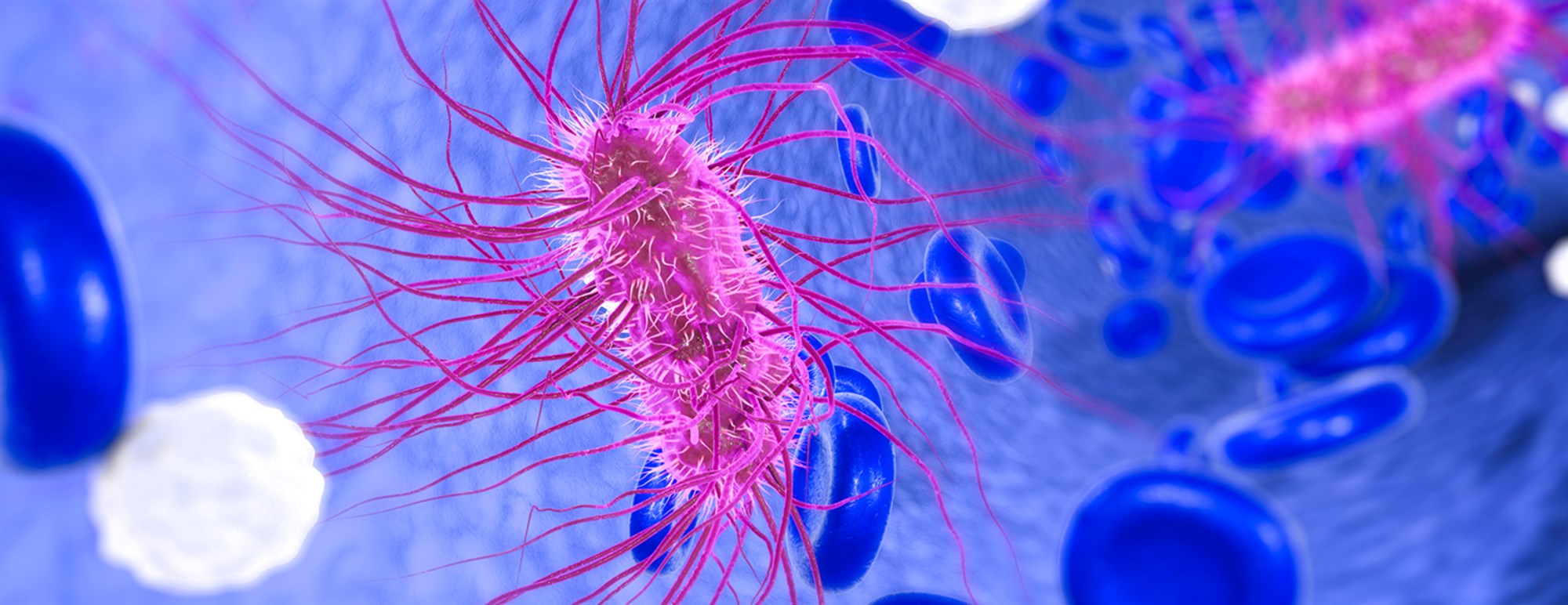 Óásættanlegt magn af bakteríum í kjöti