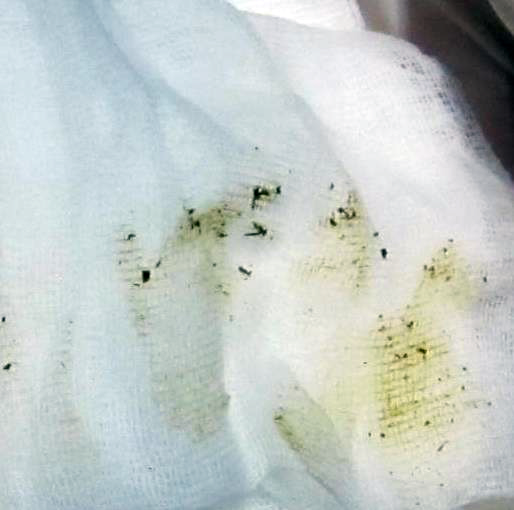 Hreinir spenaendar  = lægri frumutala!