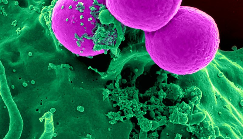 Sýklalyfjaónæmar bakteríur eru tifandi tímasprengja